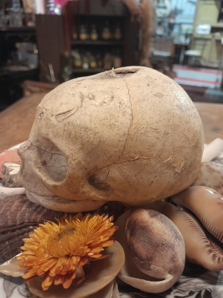 Anatomical Model By Dr. Auzoux, Papier-mâché Fetal Skull, Auzoux Workshops, 1935-photo-2