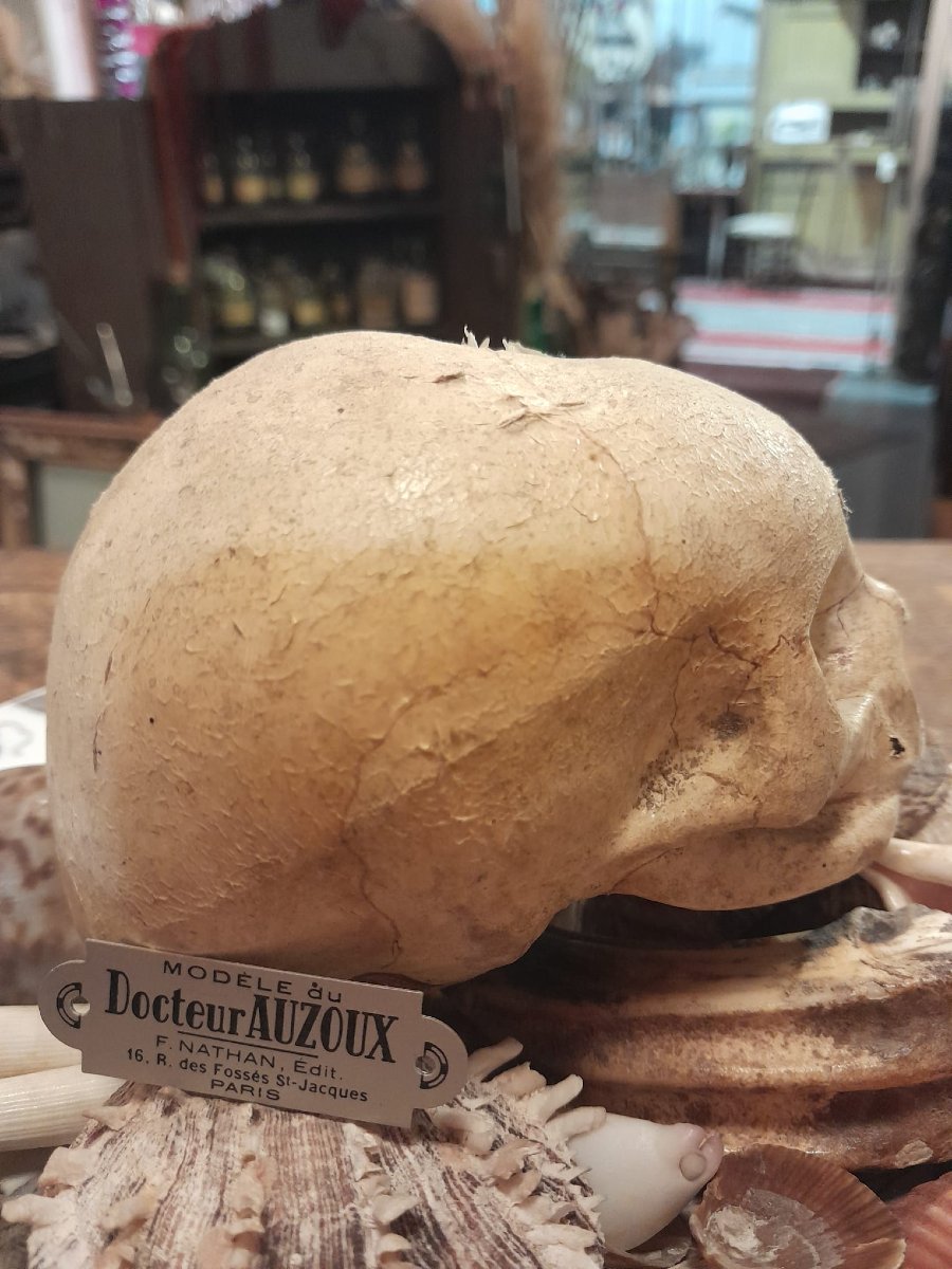 Anatomical Model By Dr. Auzoux, Papier-mâché Fetal Skull, Auzoux Workshops, 1935-photo-2