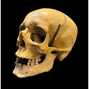Superbe Crâne Humain Médical Antique Avec écriture Ancienne - 19e Siècle - European