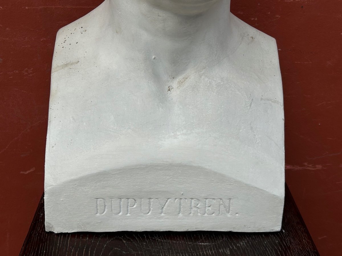 Baron Guillaume Dupuytren (1777- 1835) Buste De Bibliothèque En Plâtre - Anatomiste, Chirurgien N°5-photo-3