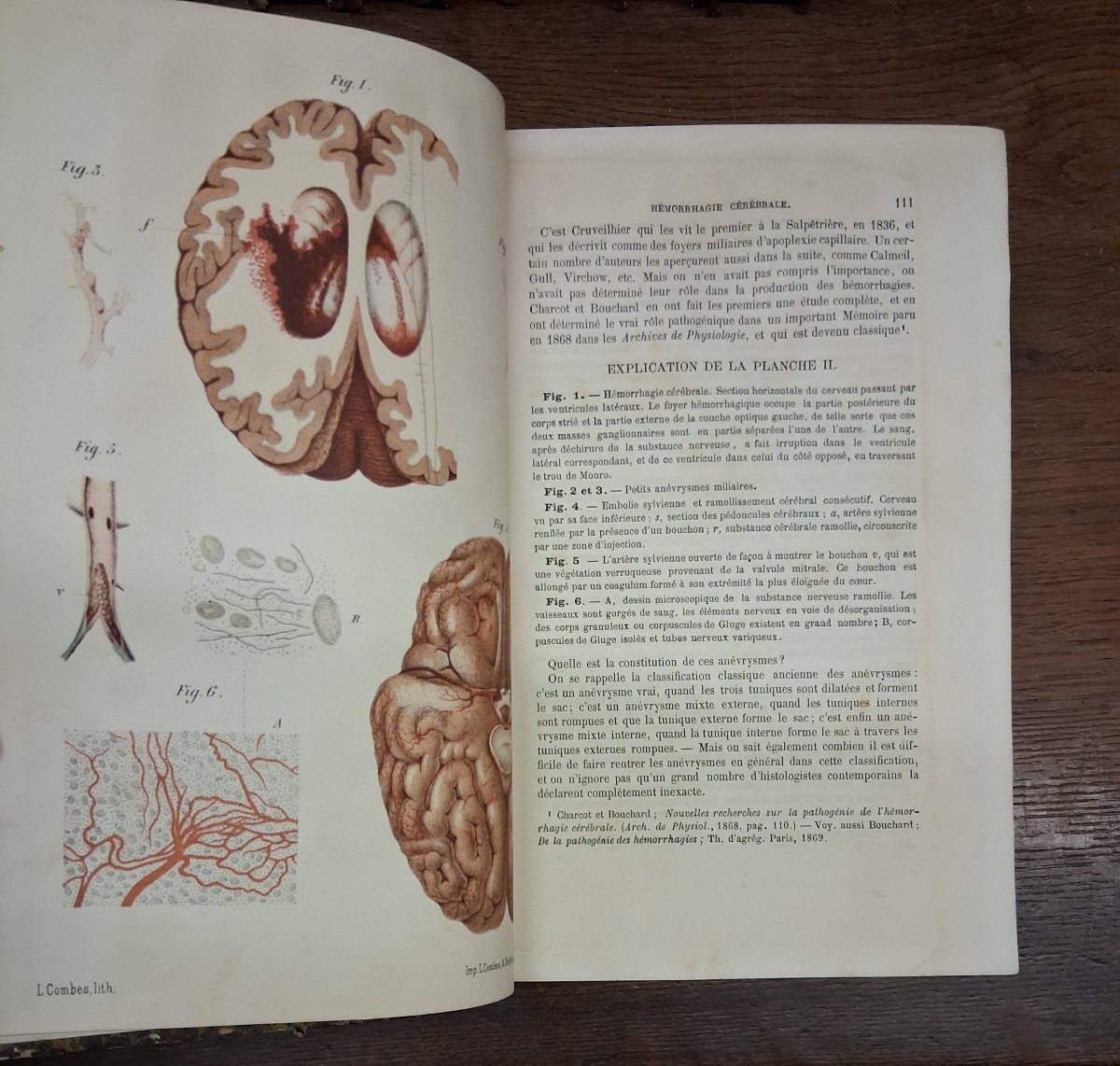 Practical Treatise On Diseases Of The Nervous System / 1881-photo-3