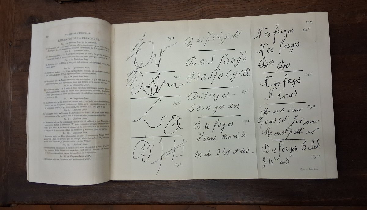 Practical Treatise On Diseases Of The Nervous System / 1881-photo-4