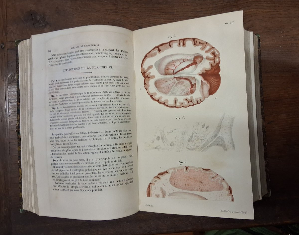 Practical Treatise On Diseases Of The Nervous System / 1881-photo-1