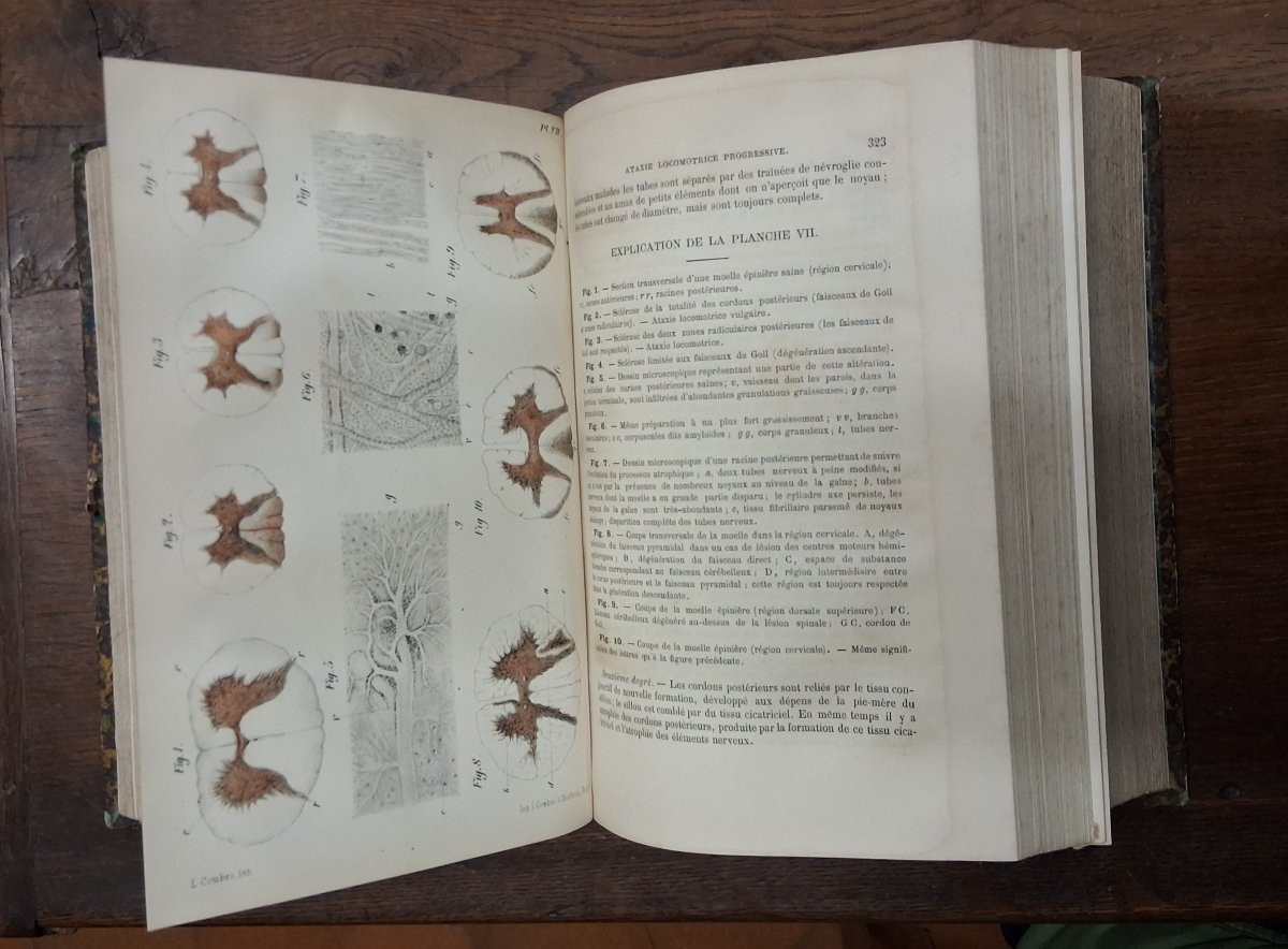 Practical Treatise On Diseases Of The Nervous System / 1881-photo-2