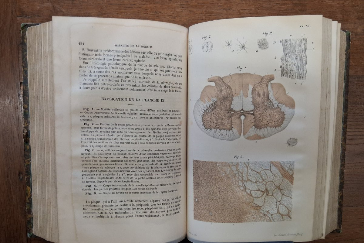 Practical Treatise On Diseases Of The Nervous System / 1881-photo-3
