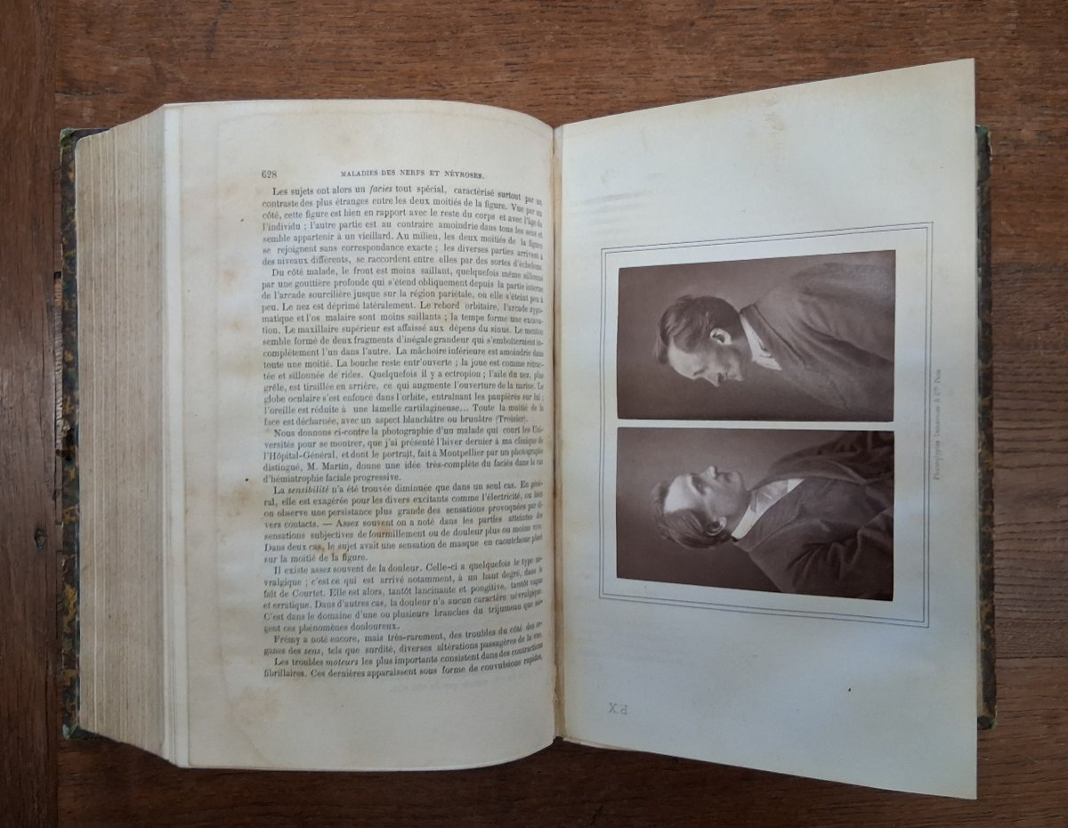Practical Treatise On Diseases Of The Nervous System / 1881-photo-4