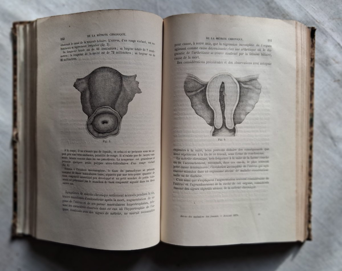 Revue Médico-Chirurgicale des Maladies des Femmes / 1880-photo-3