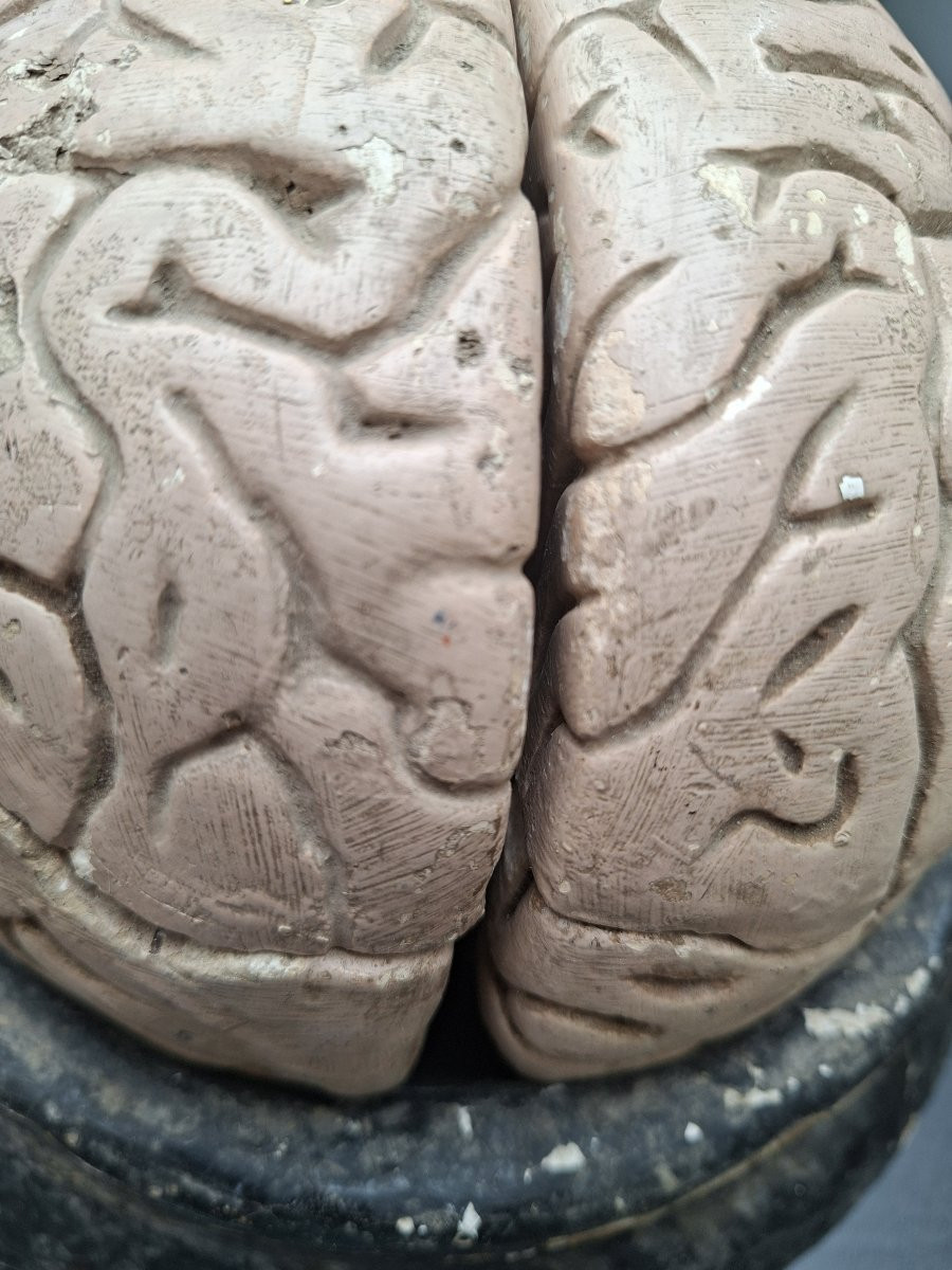 The Brain In All Its Forms Didactics 19th...auzoux Bock-steger Or Tramond-photo-2