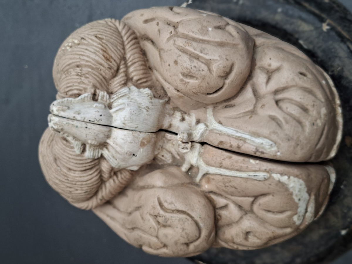 The Brain In All Its Forms Didactics 19th...auzoux Bock-steger Or Tramond-photo-2