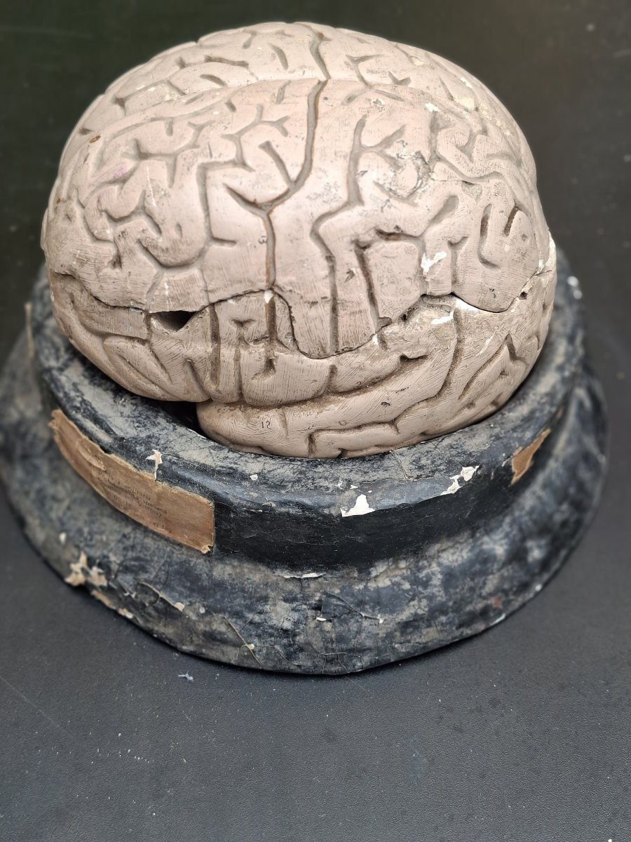 The Brain In All Its Forms Didactics 19th...auzoux Bock-steger Or Tramond-photo-4
