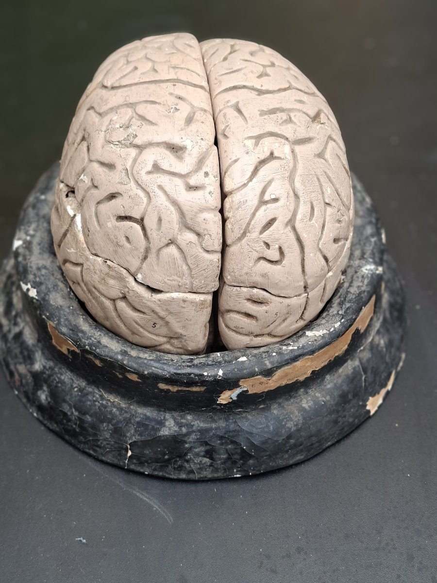 The Brain In All Its Forms Didactics 19th...auzoux Bock-steger Or Tramond-photo-5