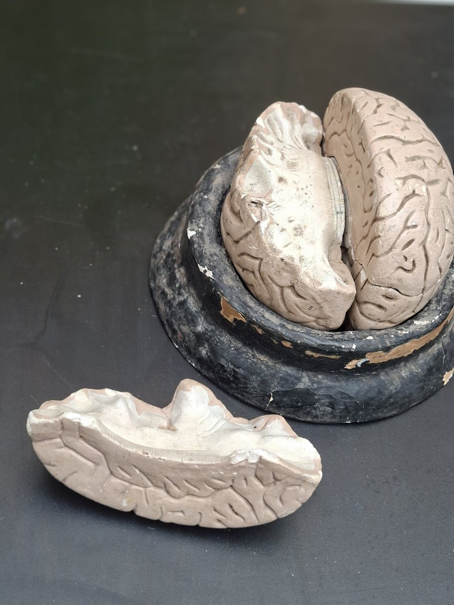 The Brain In All Its Forms Didactics 19th...auzoux Bock-steger Or Tramond-photo-6