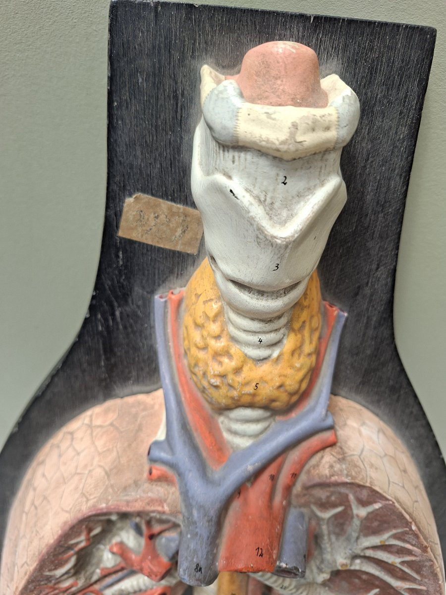 Des poumons et une trachée du XIXe siècle…-photo-3