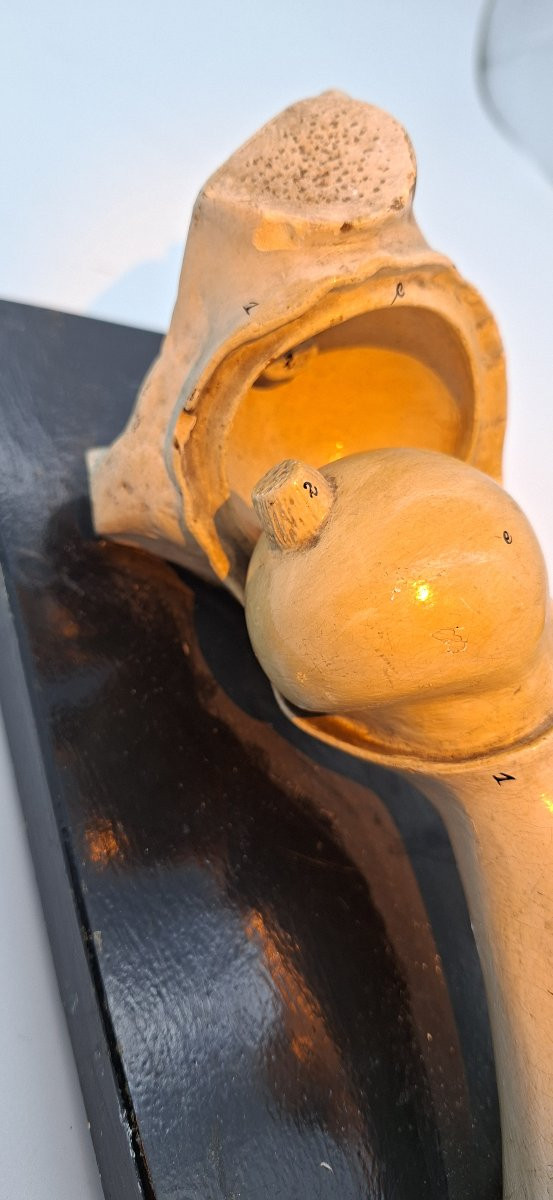 anatomie de la hanche XIXe didactique-photo-3