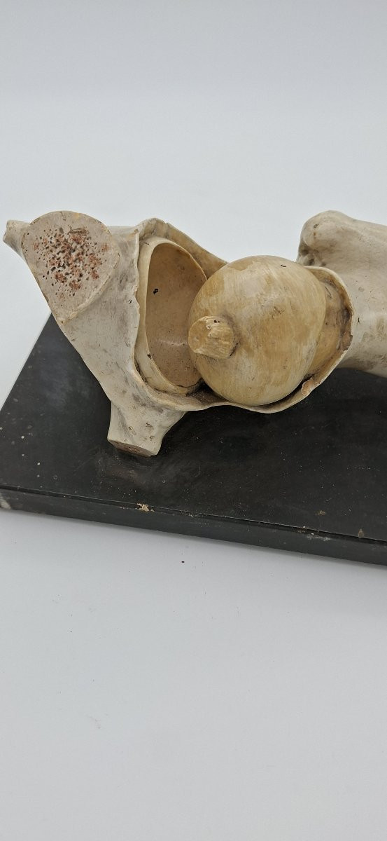 anatomie de la hanche XIXe didactique-photo-1