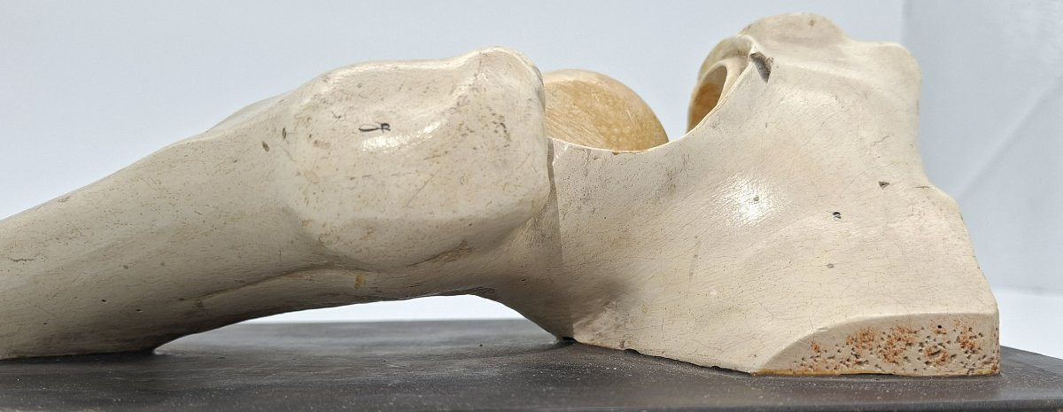 anatomie de la hanche XIXe didactique-photo-2