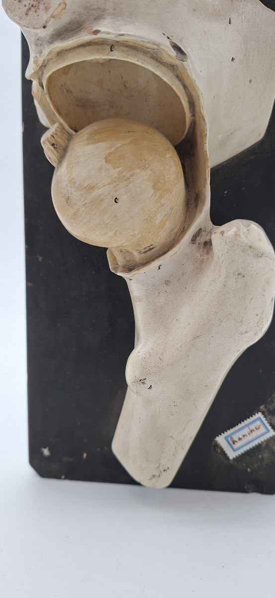 anatomie de la hanche XIXe didactique-photo-3