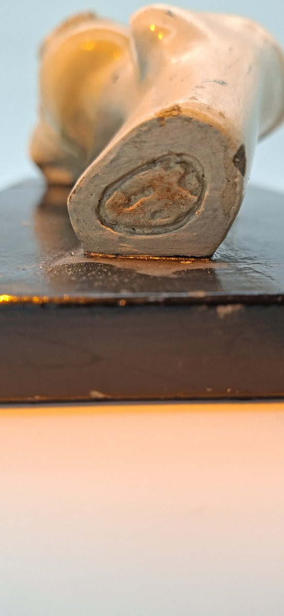 anatomie de la hanche XIXe didactique-photo-4