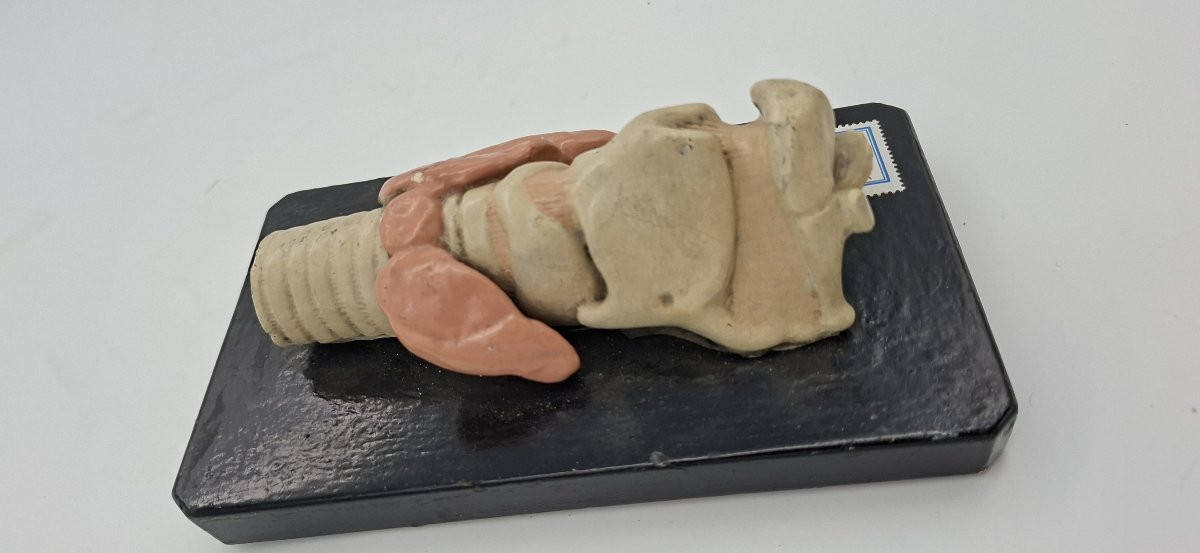 un larynx anatomique du XIXe siècle-photo-2