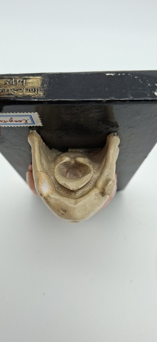 un larynx anatomique du XIXe siècle-photo-3