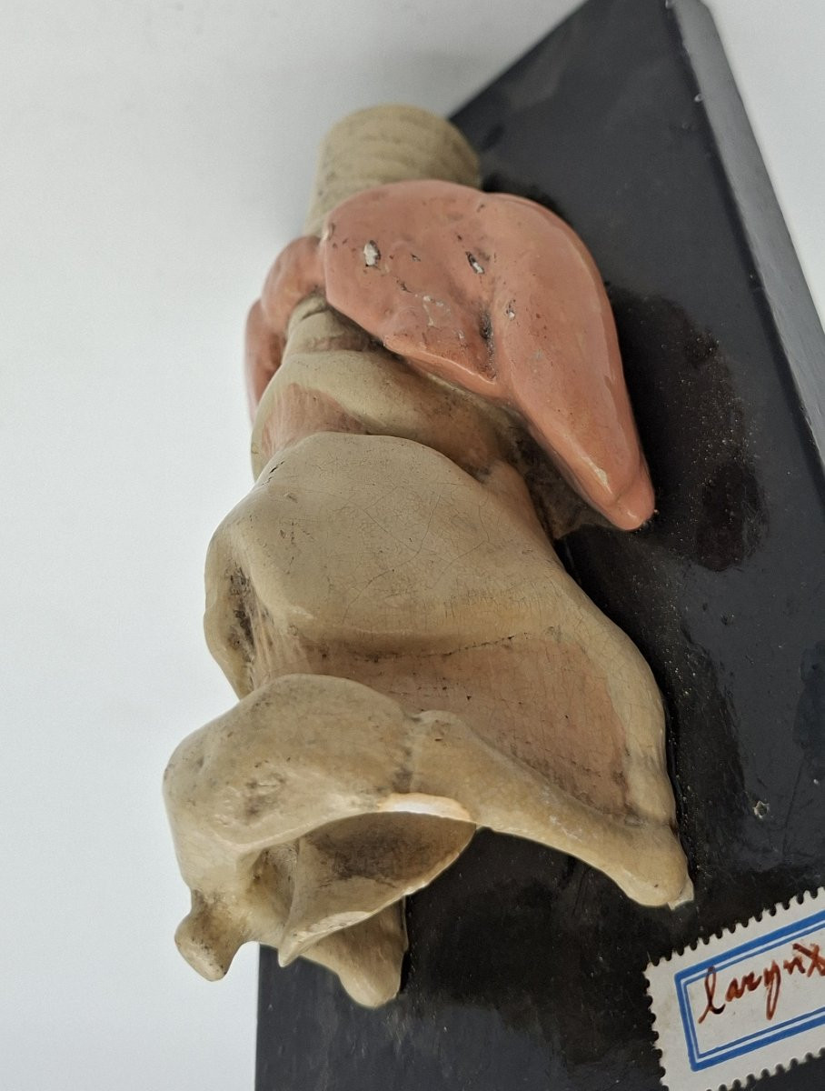 un larynx anatomique du XIXe siècle-photo-1