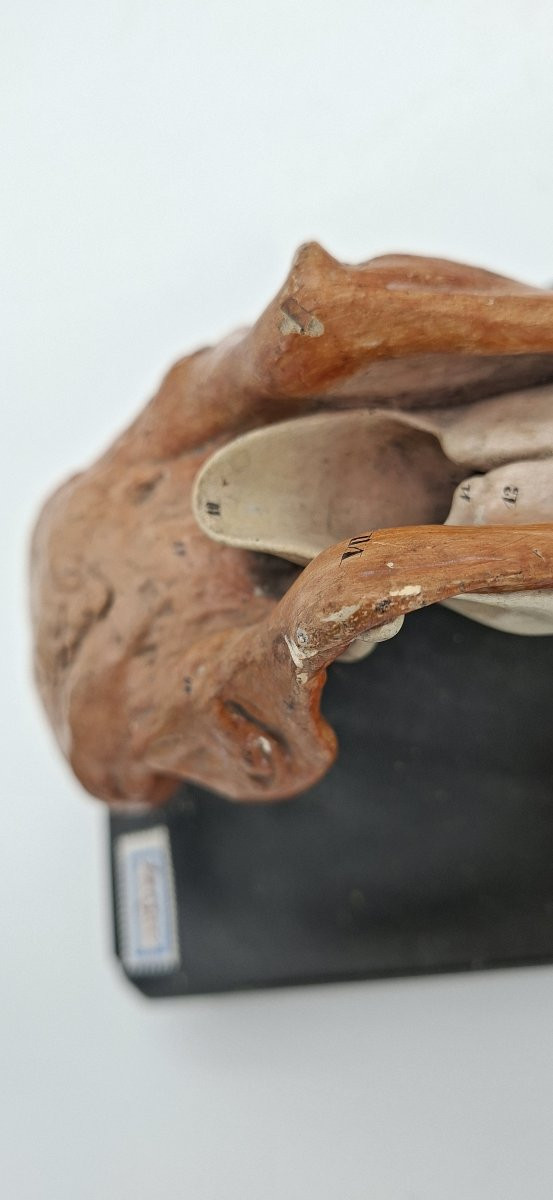 What Language Are We Talking About? Anatomical…-photo-2