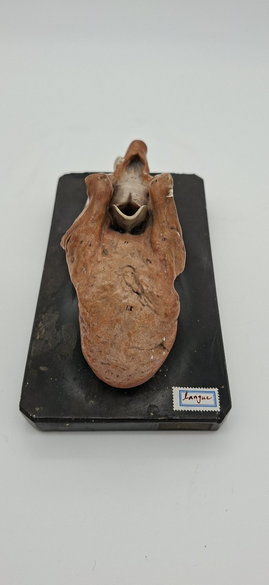 What Language Are We Talking About? Anatomical…