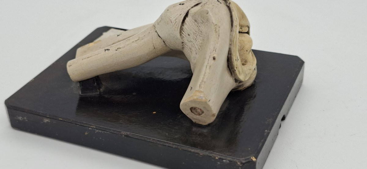 anatomie de l'articulation du coude-photo-4