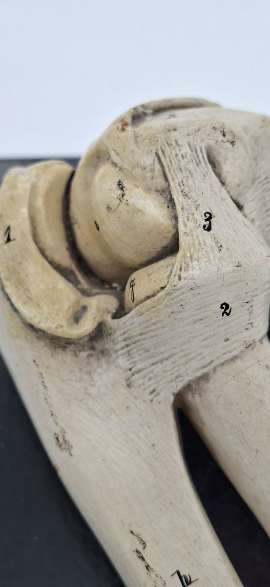 anatomie de l'articulation du coude-photo-2