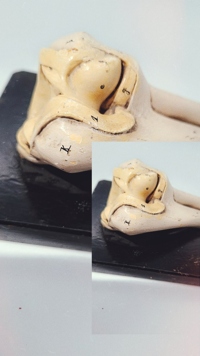 anatomie de l'articulation du coude-photo-3