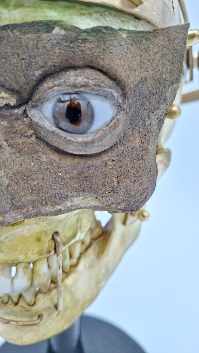 CRANIOMETRE DE BONNE ANNEE-photo-2