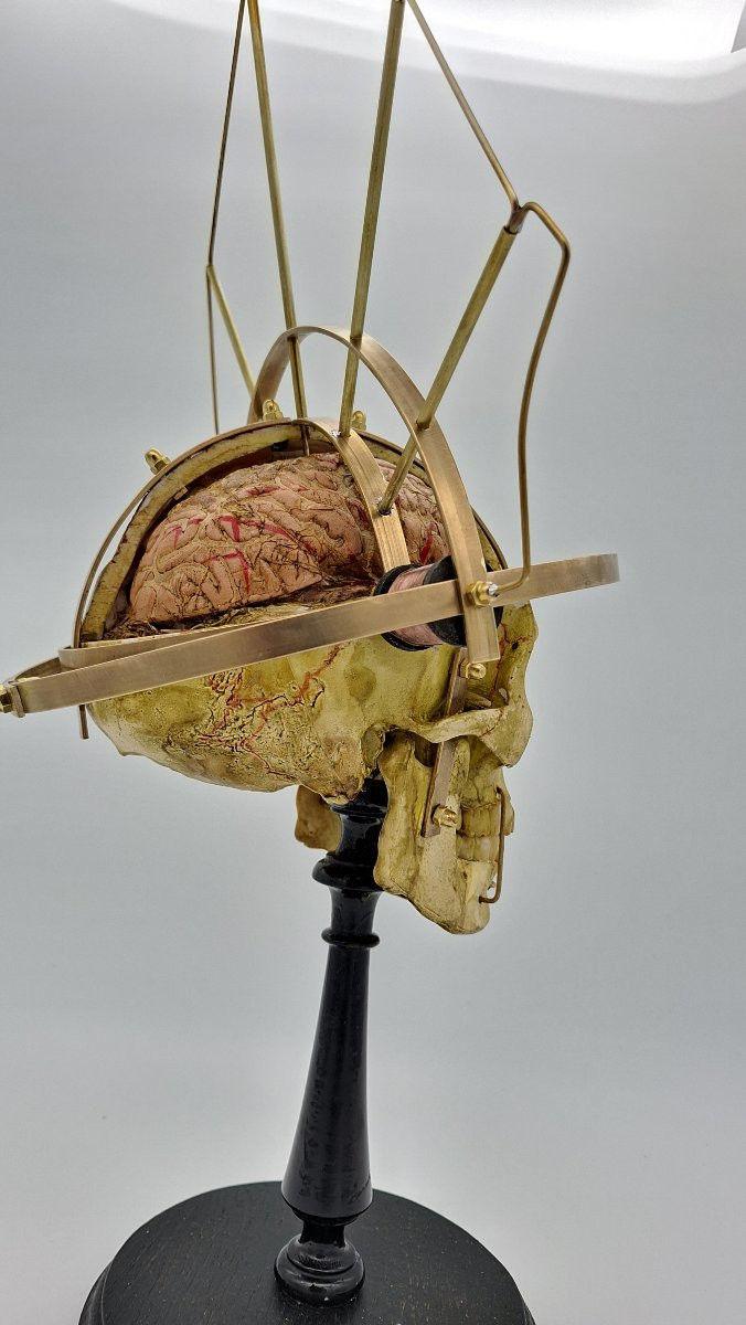 CRANIOMETRE DE BONNE ANNEE-photo-5