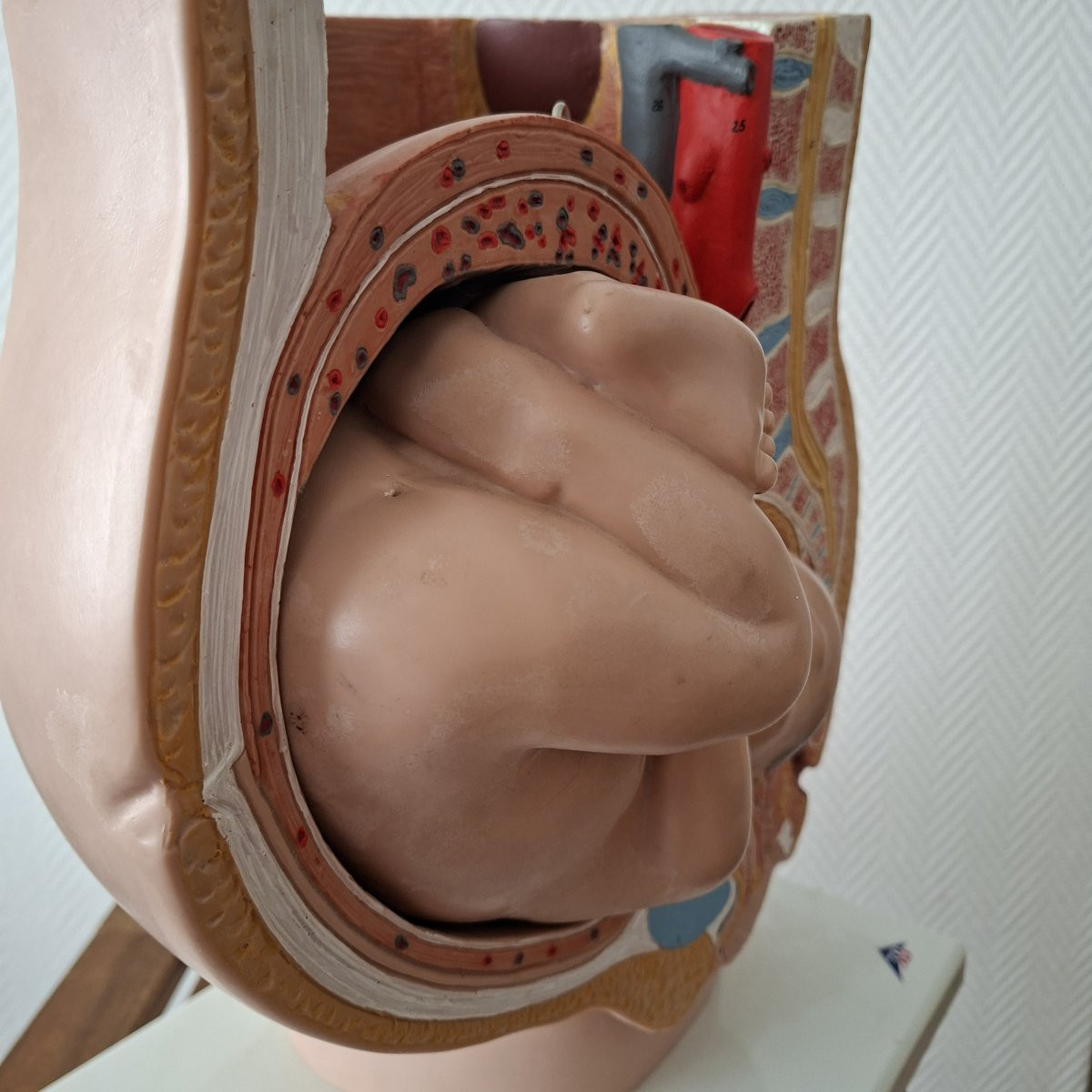 3d Obstetrical Baby-photo-2