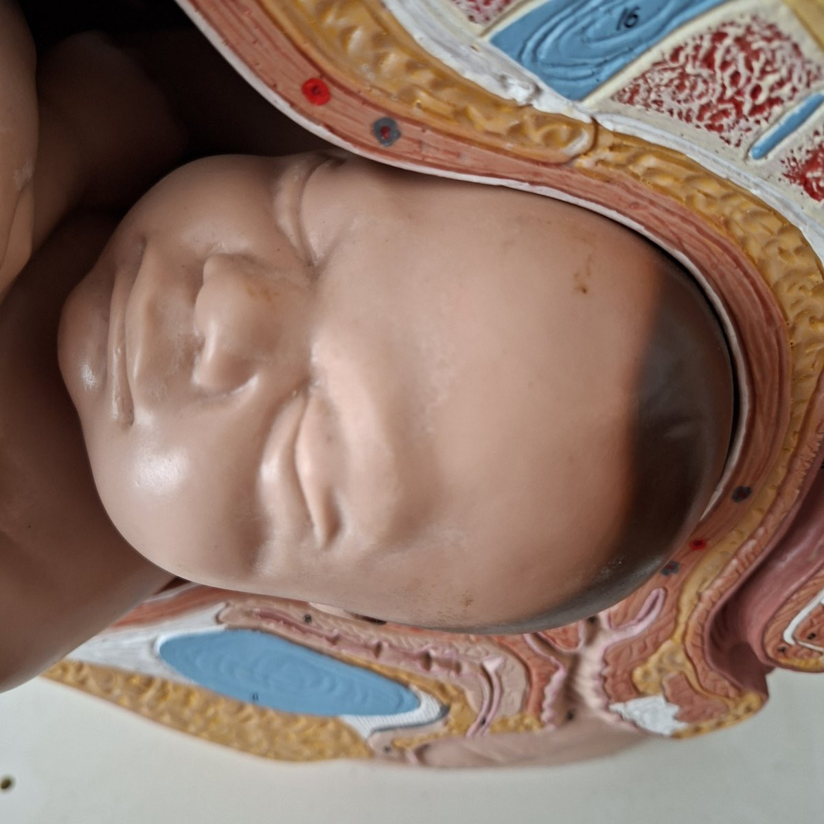 3d Obstetrical Baby-photo-4