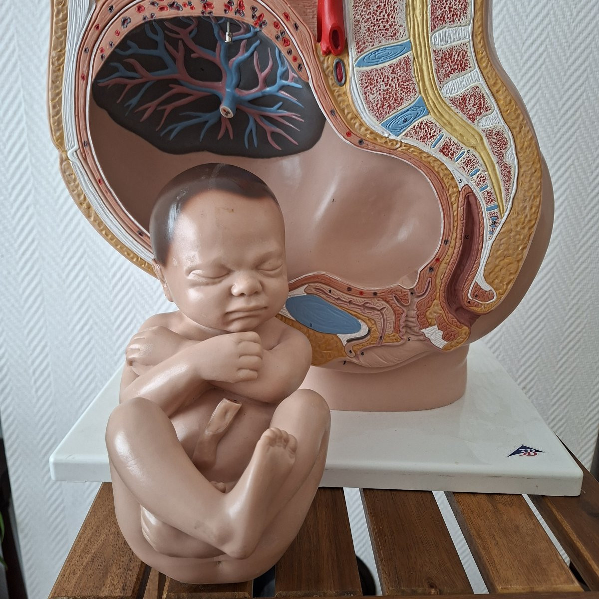 3d Obstetrical Baby-photo-6