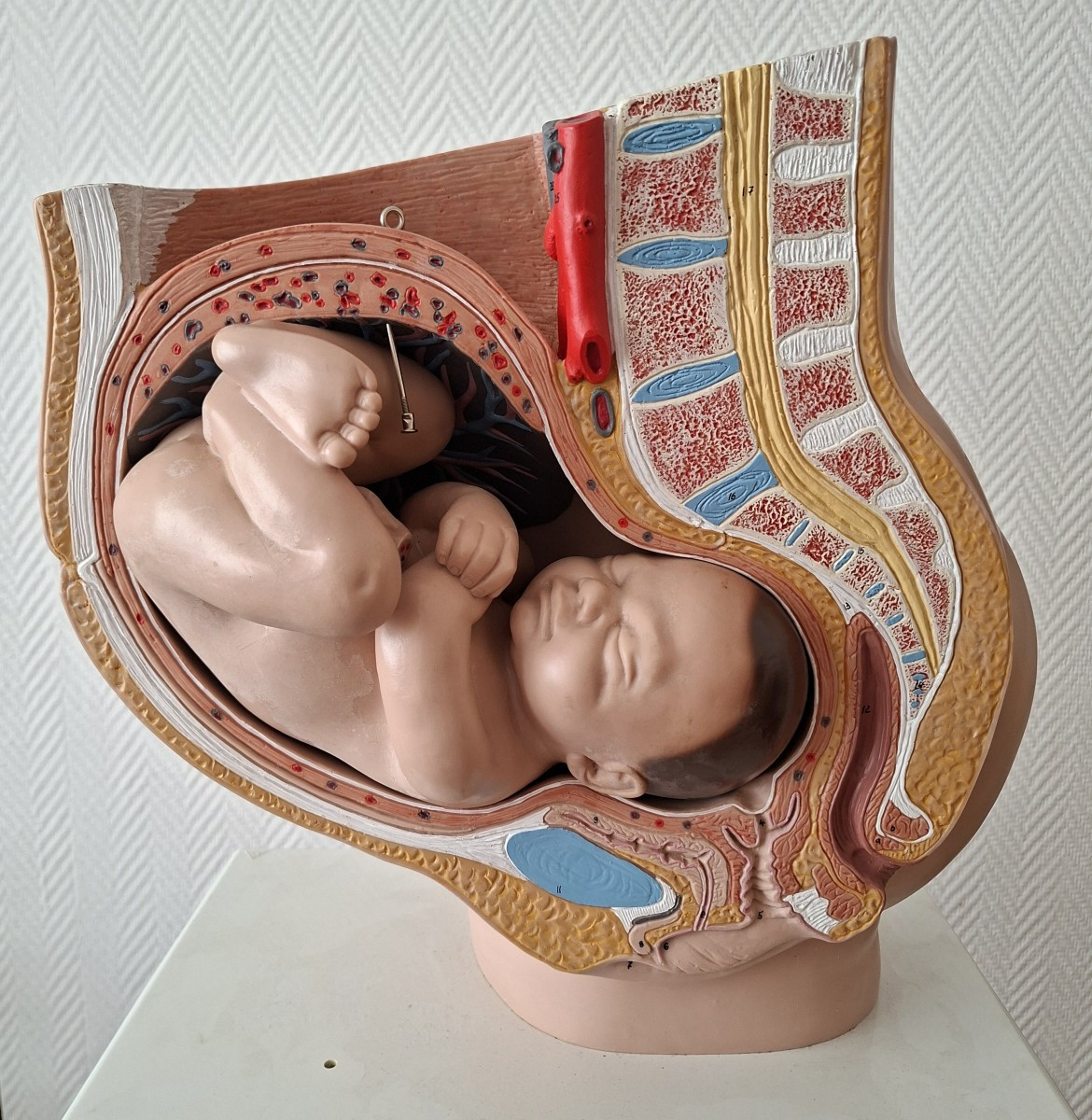 3d Obstetrical Baby