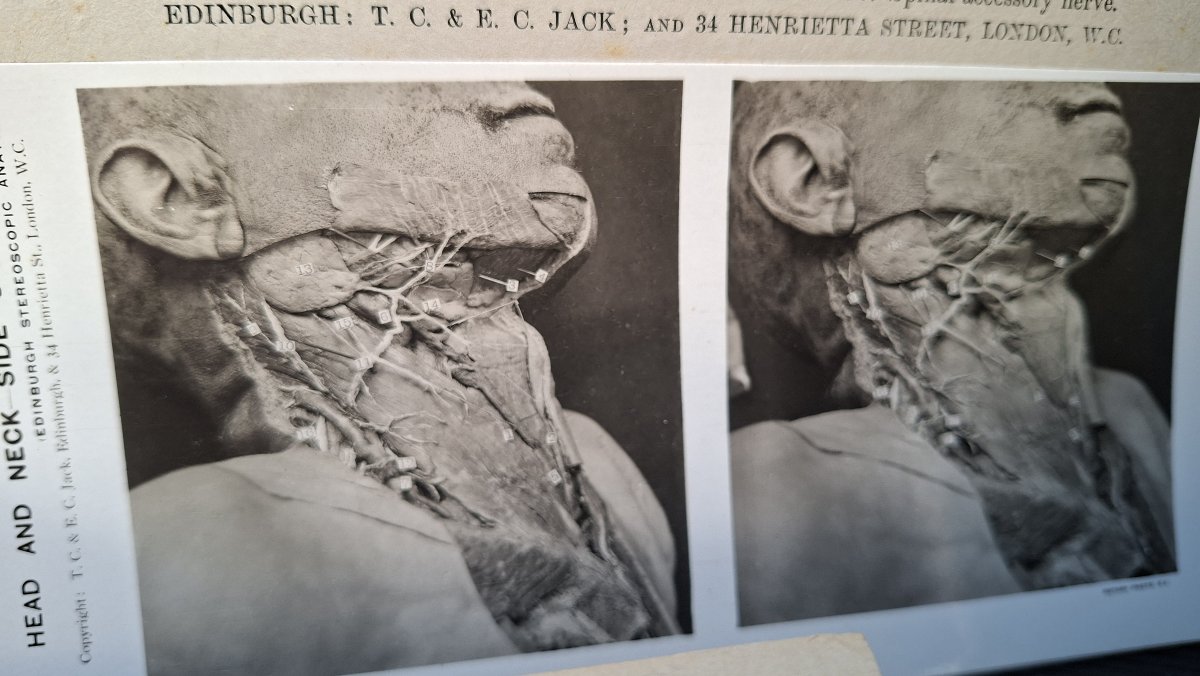 atlas du cerveau en 3D edimburg 1906 dissection-photo-2