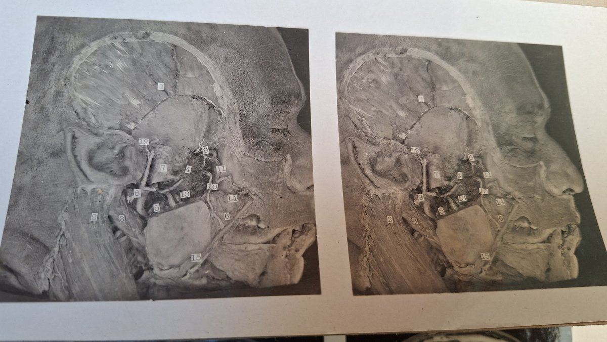 atlas du cerveau en 3D edimburg 1906 dissection-photo-3