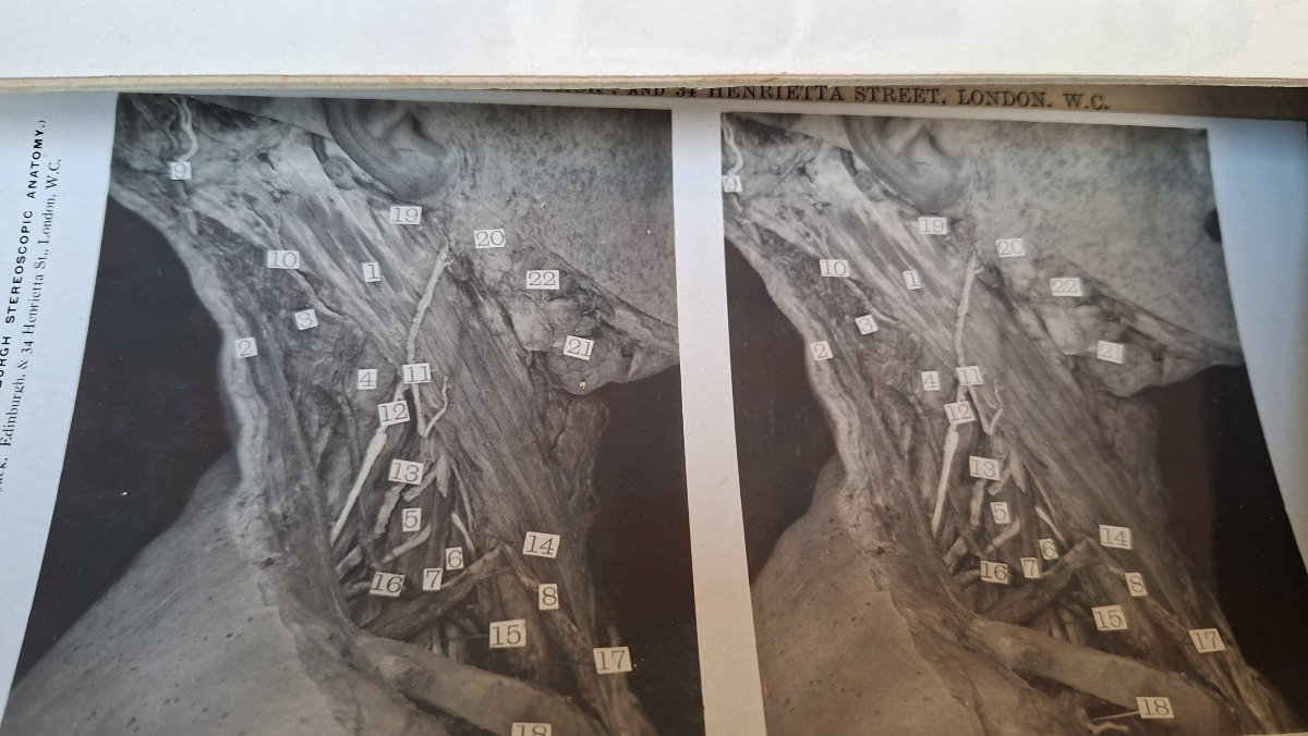 atlas du cerveau en 3D edimburg 1906 dissection-photo-4