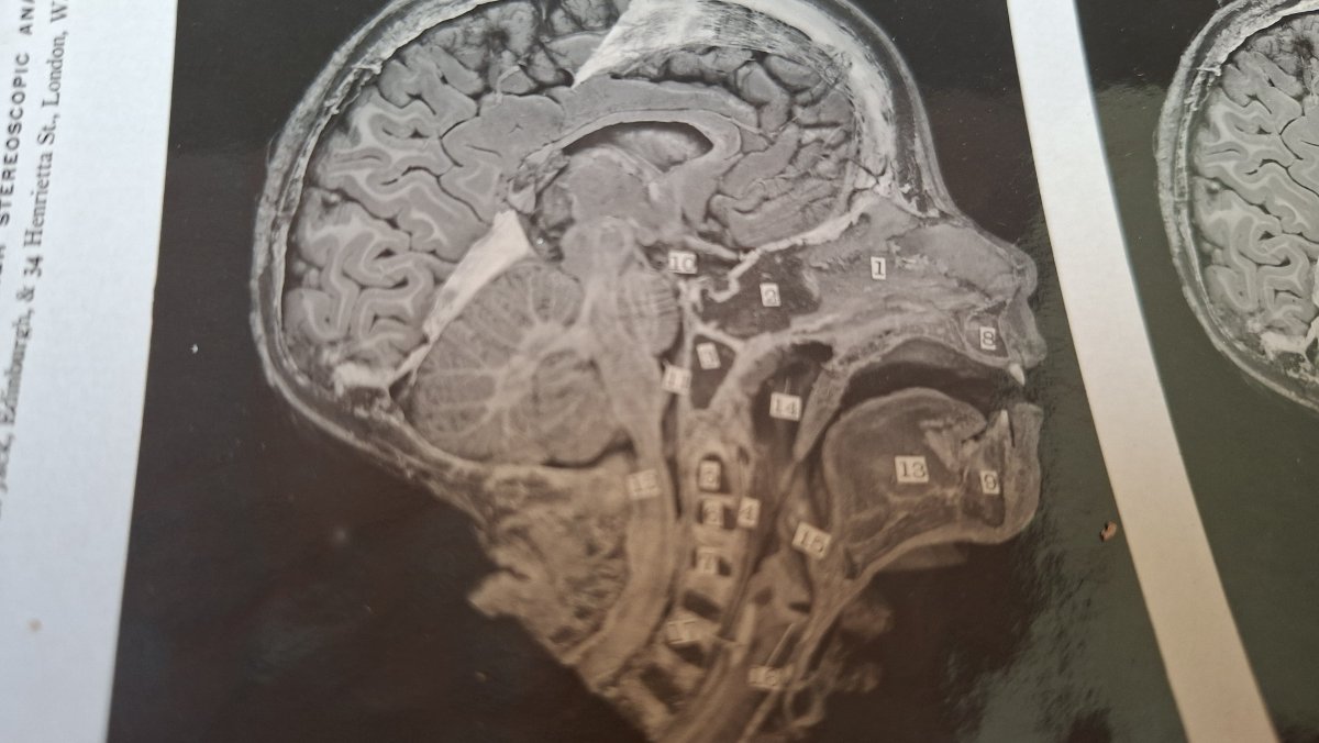 atlas du cerveau en 3D edimburg 1906 dissection-photo-1