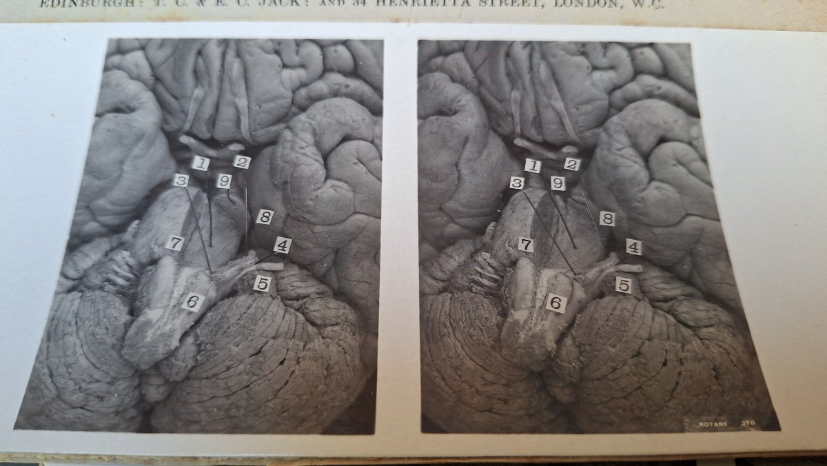 atlas du cerveau en 3D edimburg 1906 dissection-photo-2