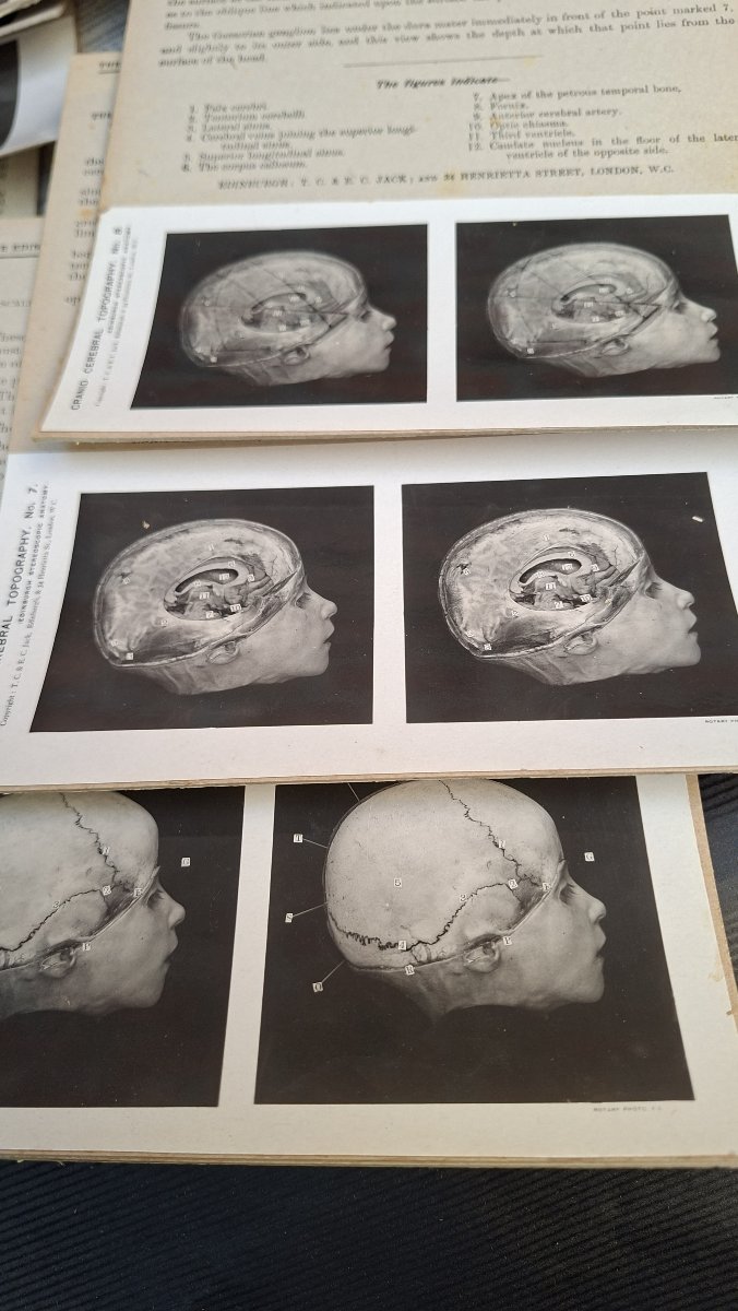 atlas du cerveau en 3D edimburg 1906 dissection-photo-3