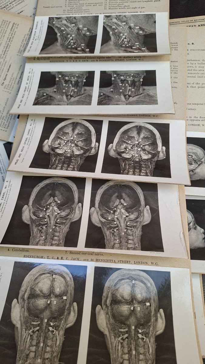 atlas du cerveau en 3D edimburg 1906 dissection-photo-4