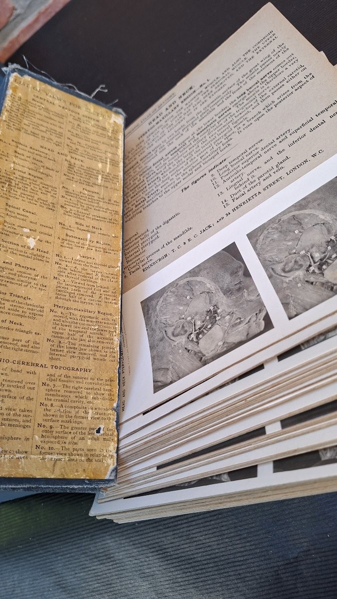 atlas du cerveau en 3D edimburg 1906 dissection-photo-6