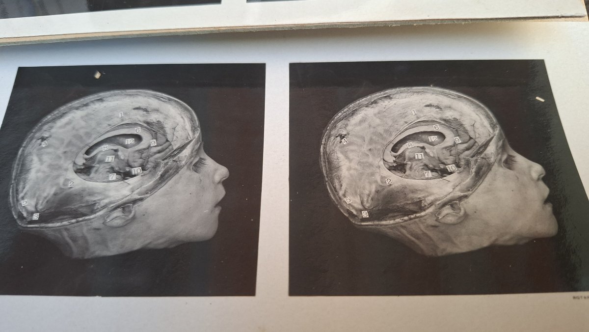 atlas du cerveau en 3D edimburg 1906 dissection-photo-8