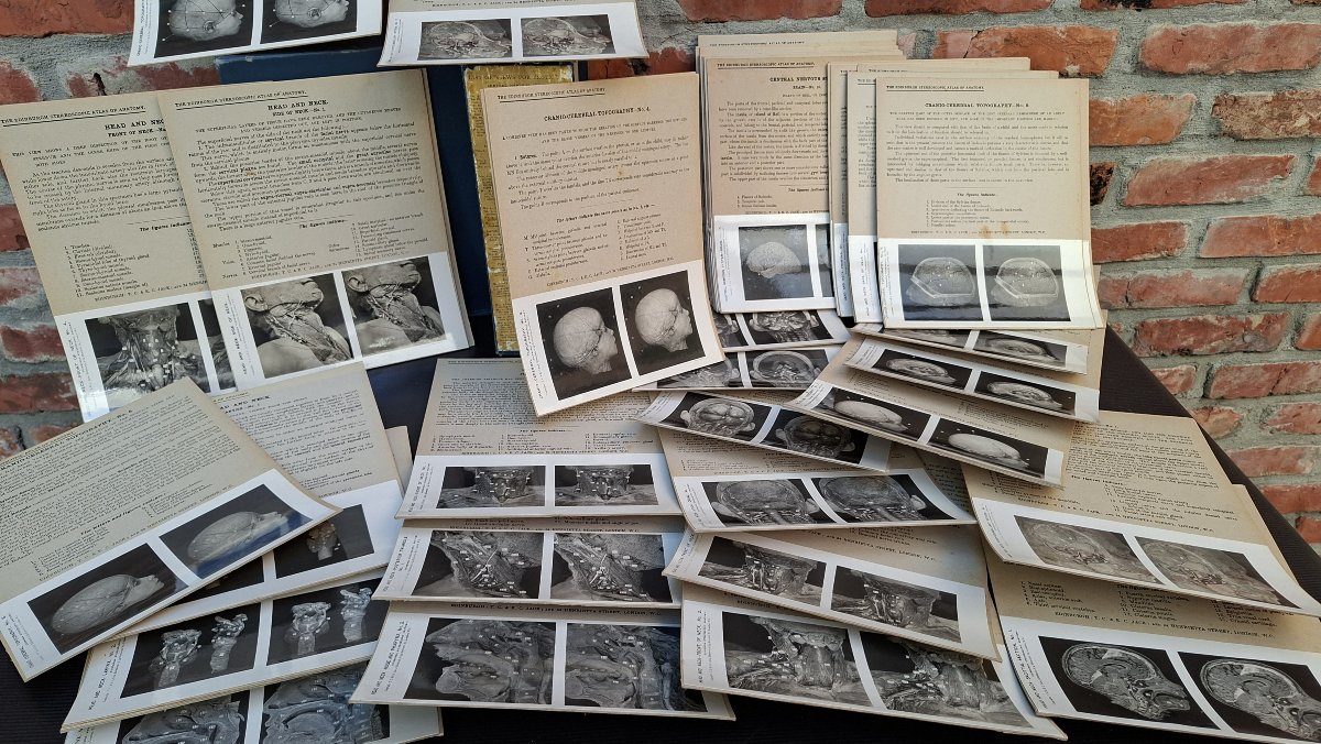 atlas du cerveau en 3D edimburg 1906 dissection