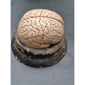 Le Cerveau Sous Toutes Ses Coutures Didactique XIXe...auzoux Bock-steger Ou Tramond