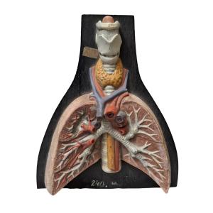 19th Century Lungs And Trachea...