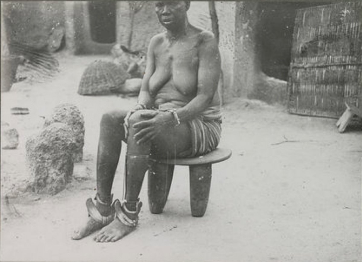 Anklet - Sénoufo Culture, Ivory Coast - 19th Century-photo-3