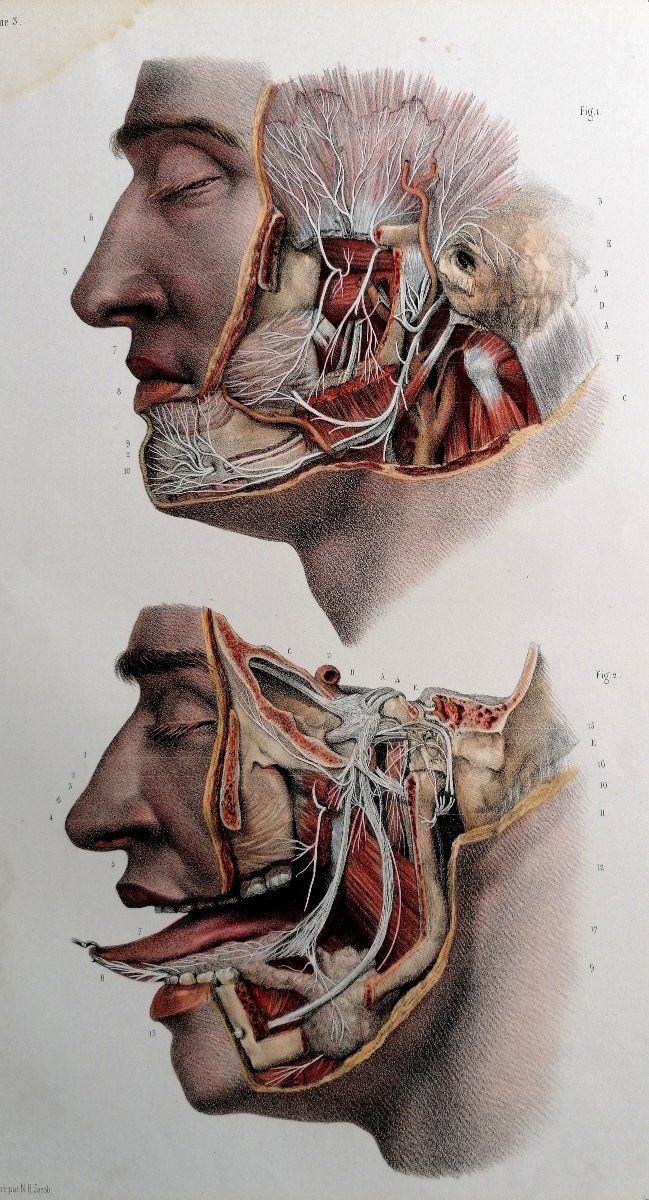 LITHOGRAPHIE - NERF TRIJUMEAU - TRAITE DE L 'ANATOMIE DE L'HOMME - Dr BOURGERY - NH JACOB --photo-4